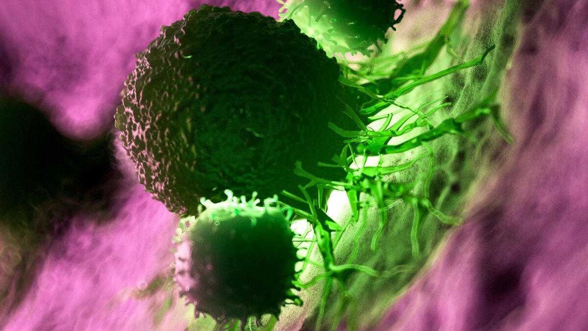 Personalized Vaccine For 'Deadliest Major Cancer' Keeps Patients Alive 6 Years Later - ScienceAlert