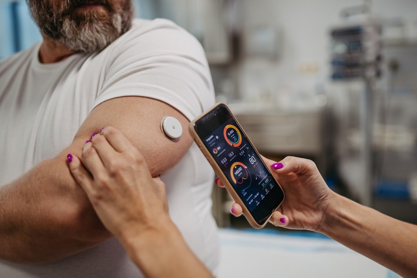 Guest column | I study wearable health data. Here’s what continuous glucose monitors miss. - The Washington Post