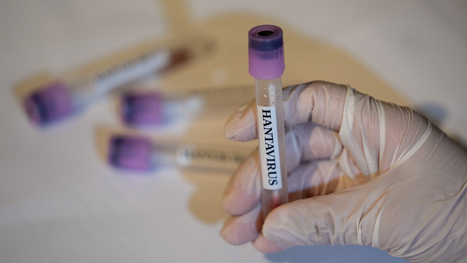 CDC says there are no U.S. hantavirus cases currently, 41 people being monitored - CNBC