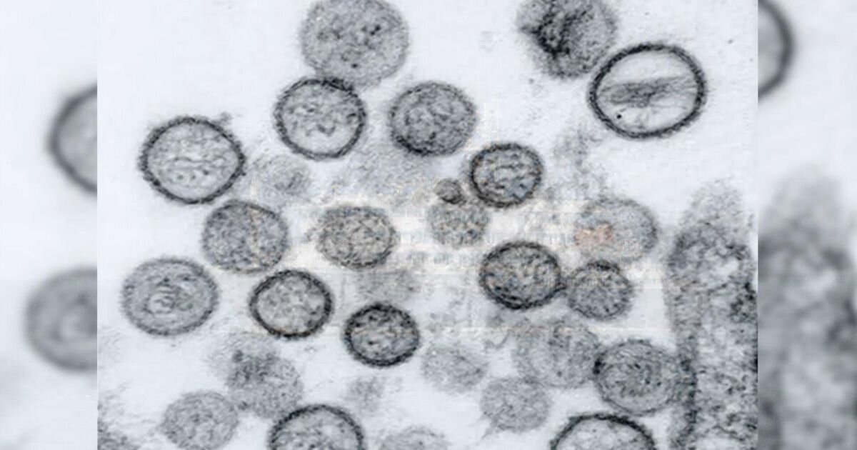 Hantavirus and COVID: Similar fears, major differences - WRAL