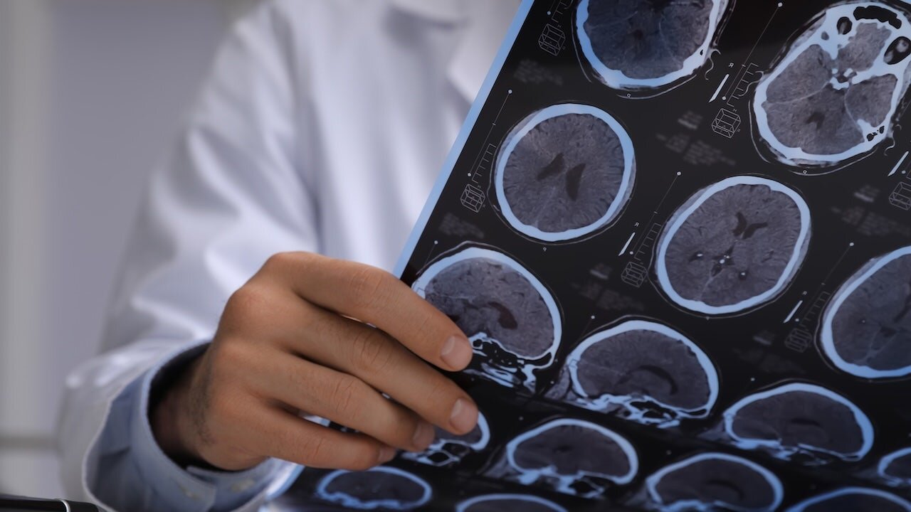 Doctors thought man had brain cancer — they found live tapeworms instead - Fox News