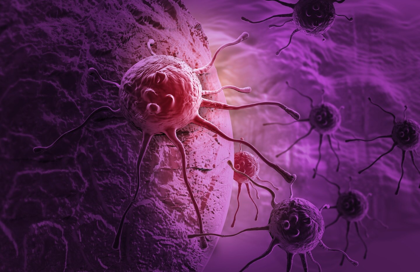 ‘Landmark’ pancreatic cancer drug keeps patients alive for twice as long - The Washington Post