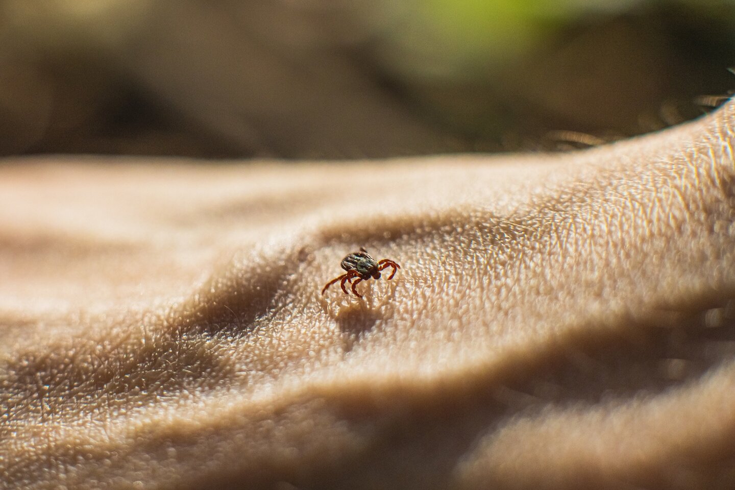 This rare tick-borne disease is on the rise in the U.S. - The Washington Post