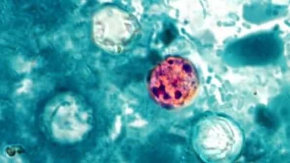 What we know about past outbreaks linked to cyclospora, the parasite that can lead to ‘explosive diarrhea’ - WCVB