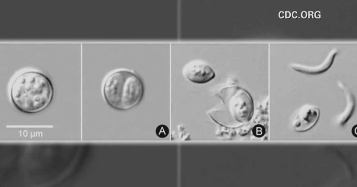 Cyclosporiasis parasitic illness cases in Maryland increase by dozens since May 1 - CBS News