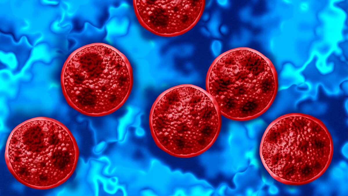There are more cases of Cyclosporiasis that have been reported in Mississippi. - WAPT