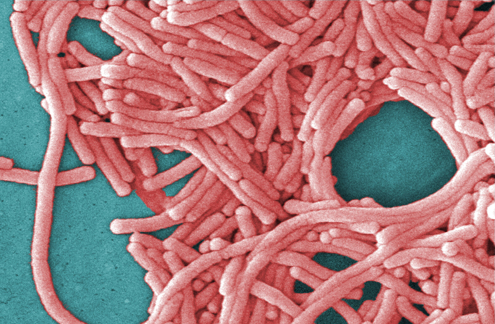 New York City health officials search for source of Upper East Side Legionnaires' outbreak linked to 36 cases - ABC7 New York