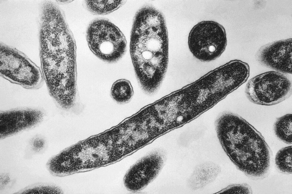 What to know about Legionnaires' disease making people sick on New York's Upper East Side - AP News