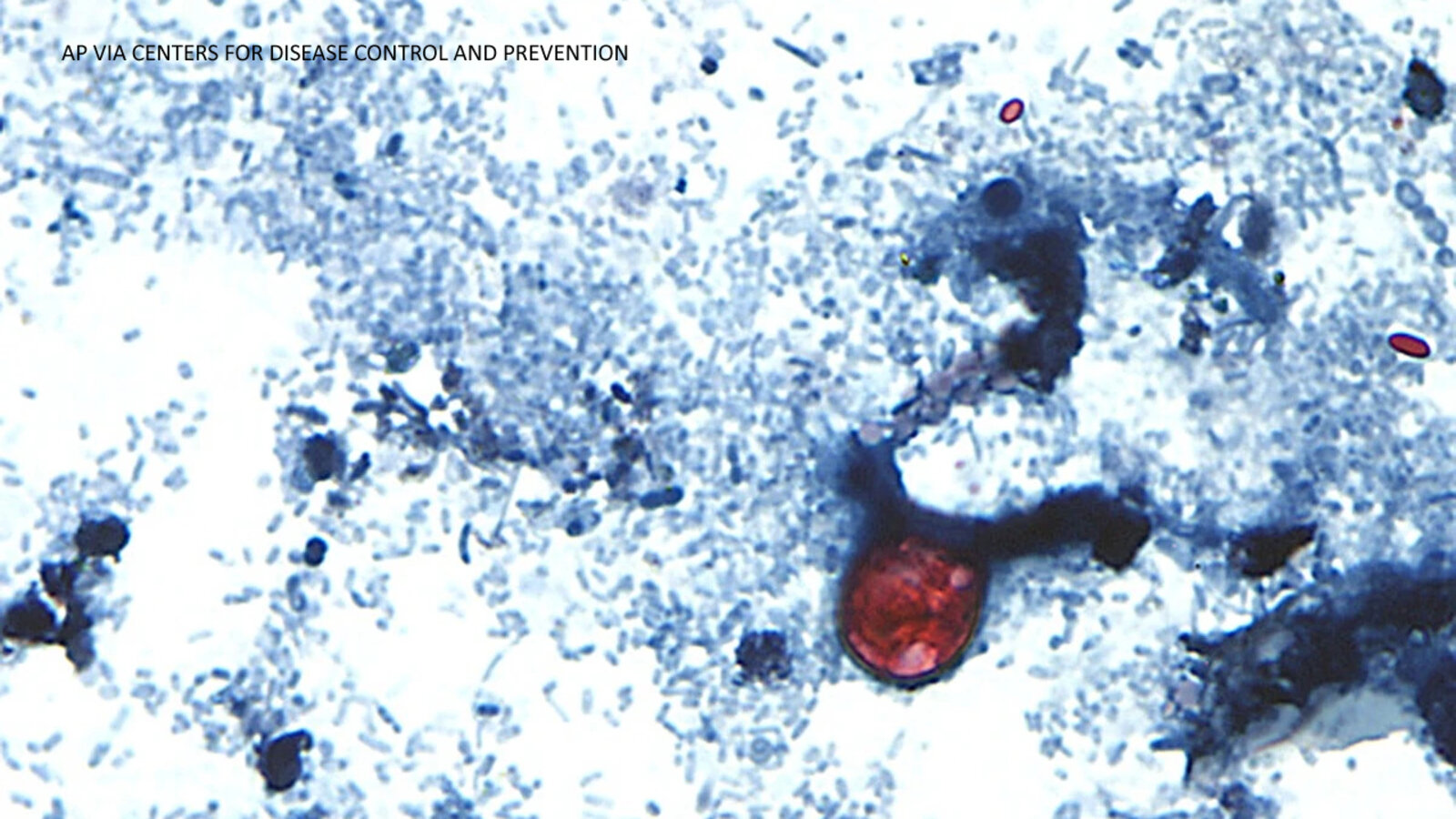 Outbreak of diarrhea caused by cyclosporiasis spreading in US with cases reported in CA, CDC says - ABC7 Los Angeles