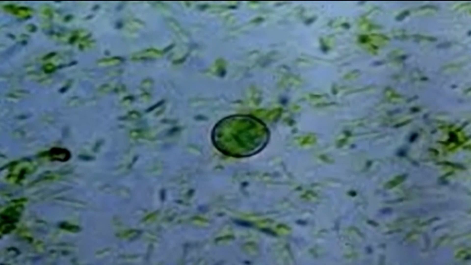 More than 60 North Carolina cases tied to parasite behind 'explosive diarrhea' - WRAL
