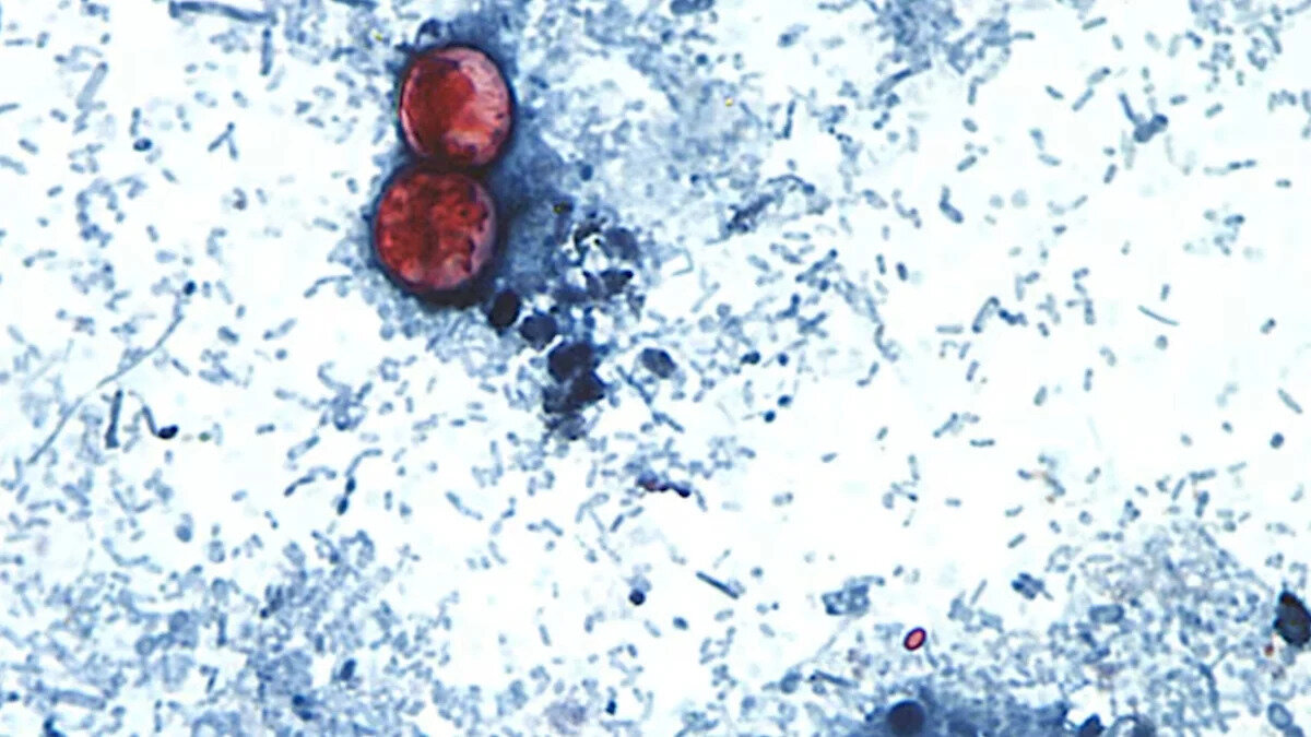 Cyclospora outbreak surges past 1,700 cases across dozens of states, with Michigan the hardest hit. Should I be worried? - Yahoo Health