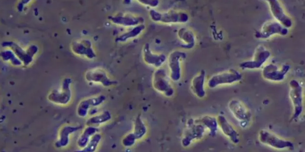 North Carolina teen critically injured by rare brain-eating amoeba - FOX Weather