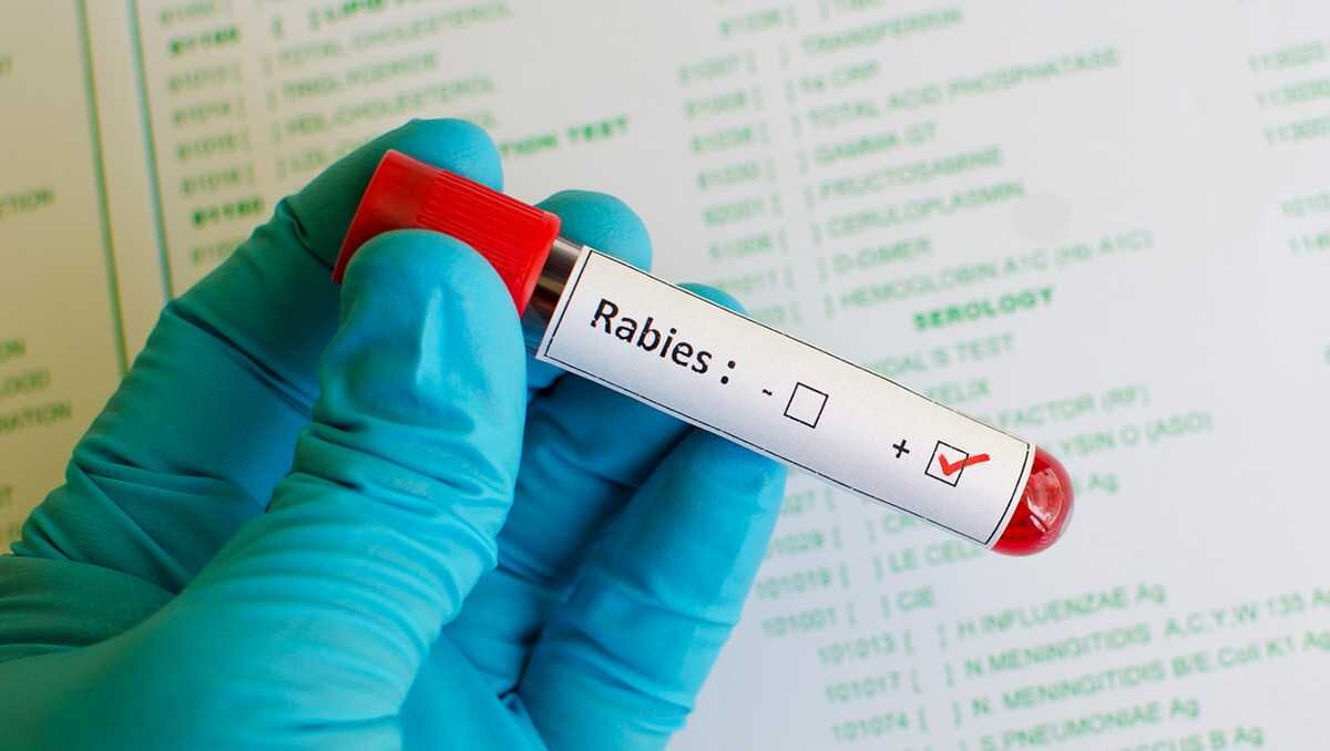 Davidson County warns of rabies exposure after four goats test positive at Lexington petting zoo - WXII
