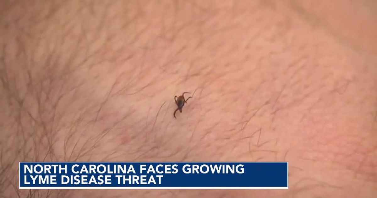 Ticks carrying Lyme disease are gaining ground in North Carolina, study finds - WRAL