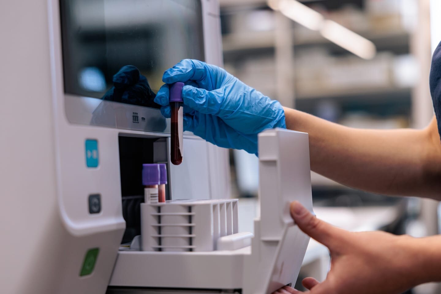 The sneaky kind of cholesterol that may be threatening your heart health - The Washington Post