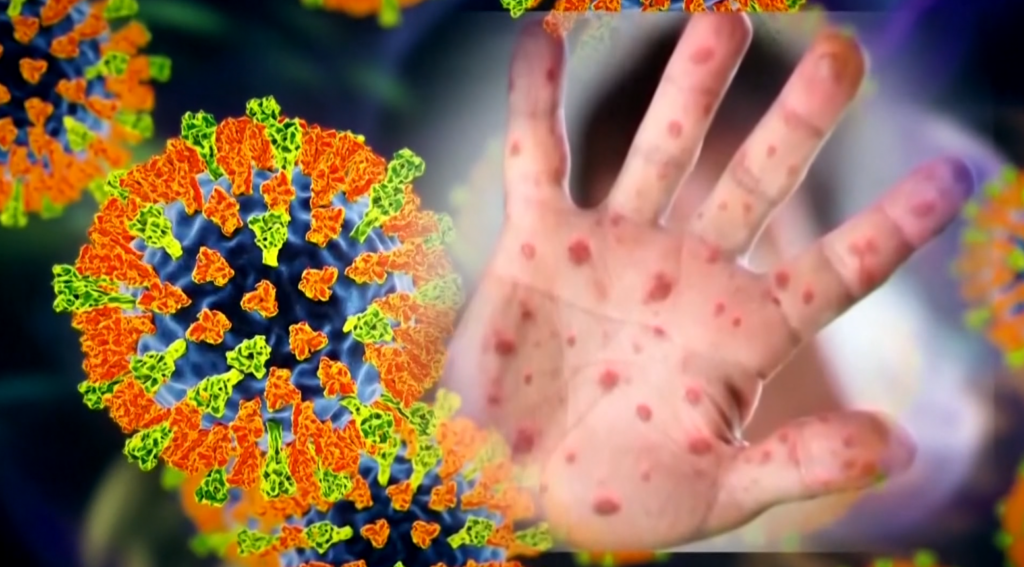 County health officials warn about possible measles exposure at Strong's emergency department - WHEC.com
