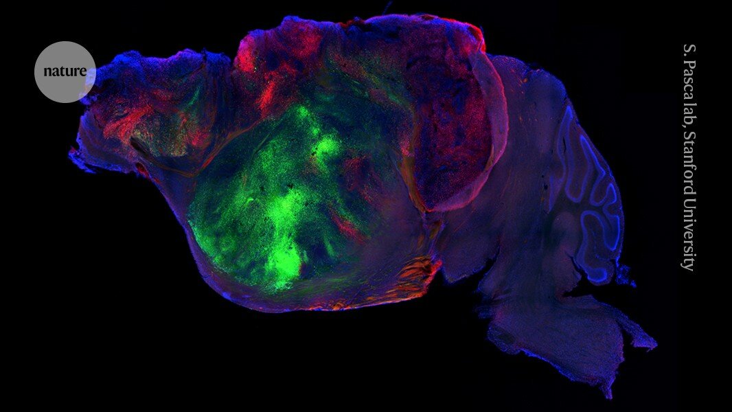 Human brain cells transplanted into mice in ‘most extensive’ integration ever - Nature