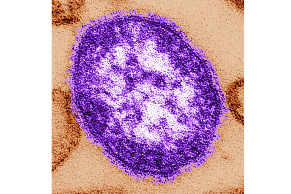 Coroner releases details of infants who died amid growing Pennsylvania measles outbreak - AP News