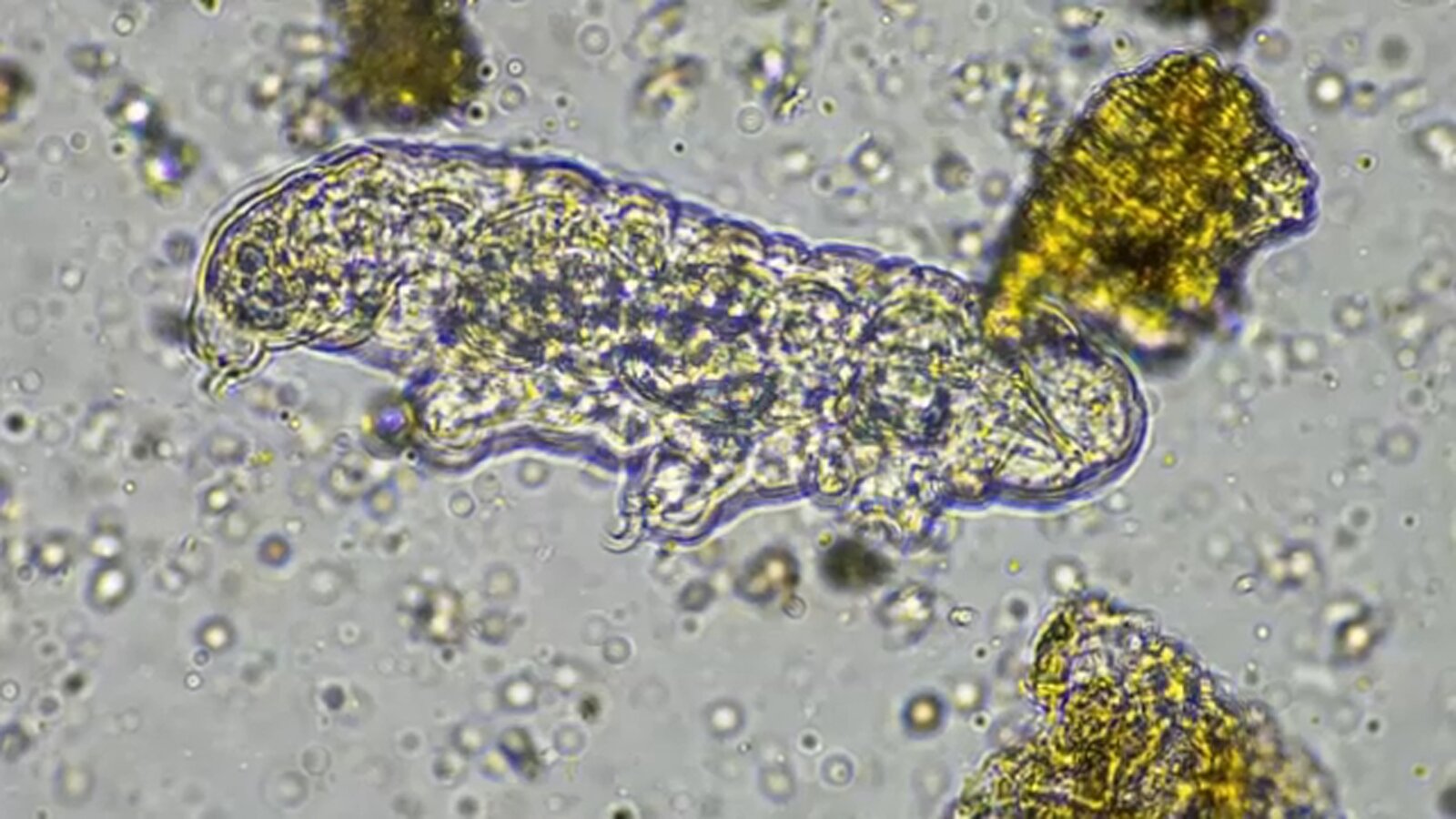 NC teen dead after contracting rare brain-eating amoeba found in freshwater health officials confirm - ABC11 News