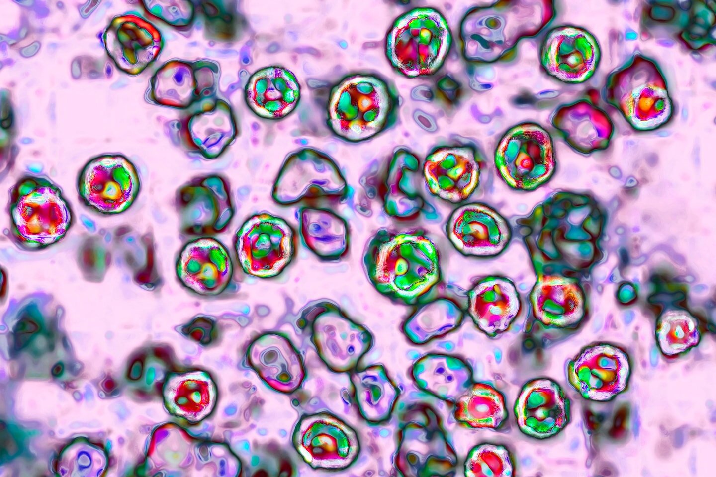 Infant died of measles in Pennsylvania, coroner confirms - The Washington Post