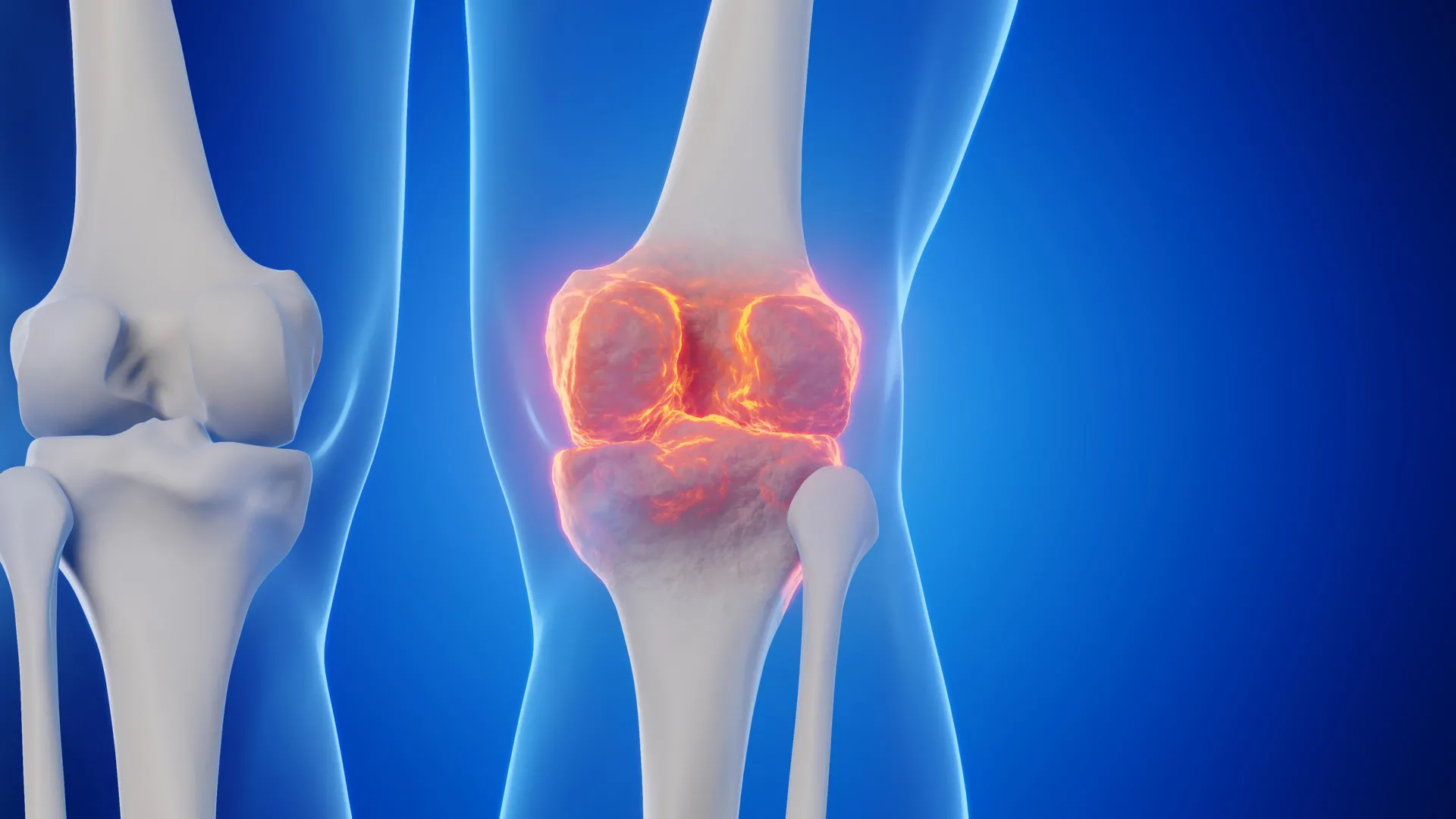 Goodbye joint replacements? Stanford scientists found a way to regrow cartilage and stop arthritis - ScienceDaily