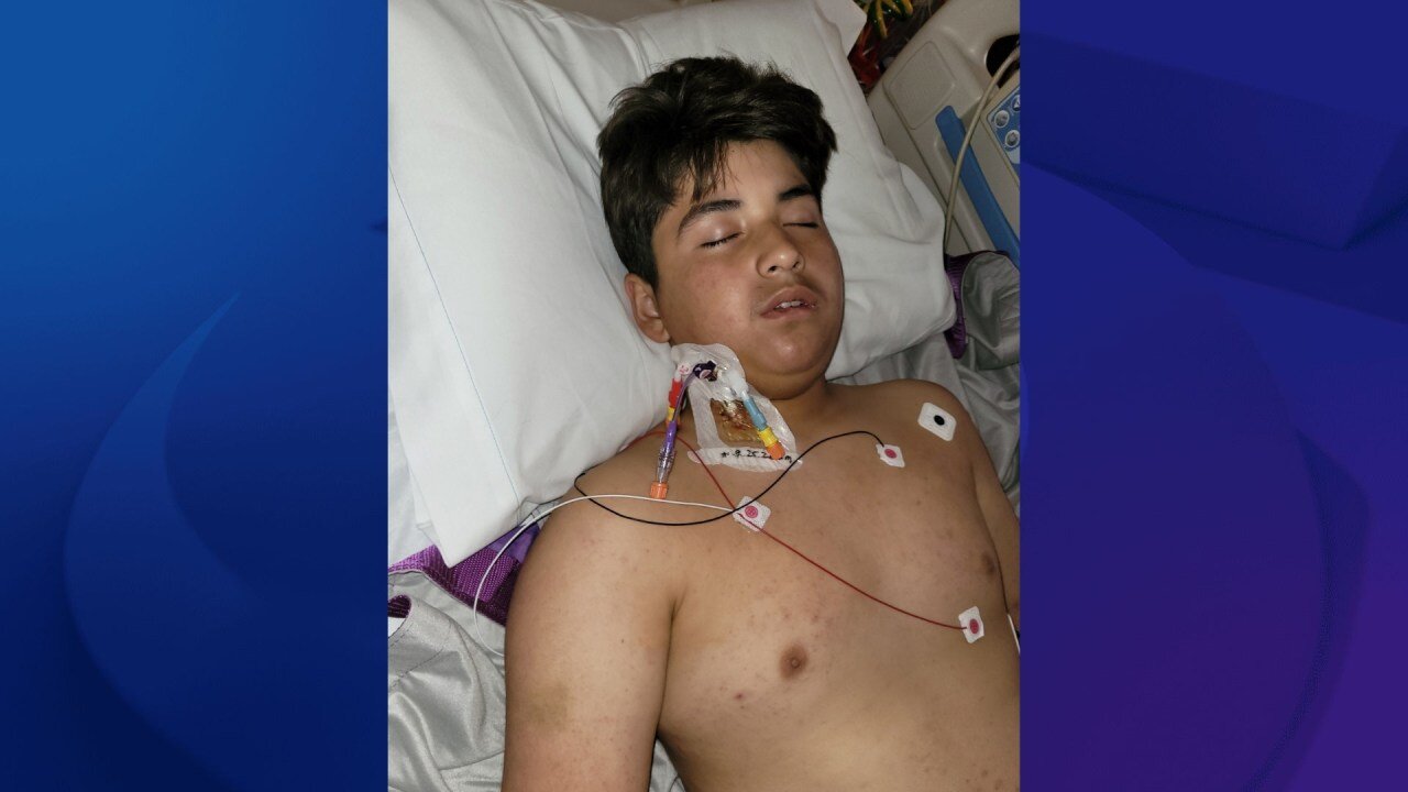 Long Beach child hospitalized with rare disease related to West Nile virus - KTLA