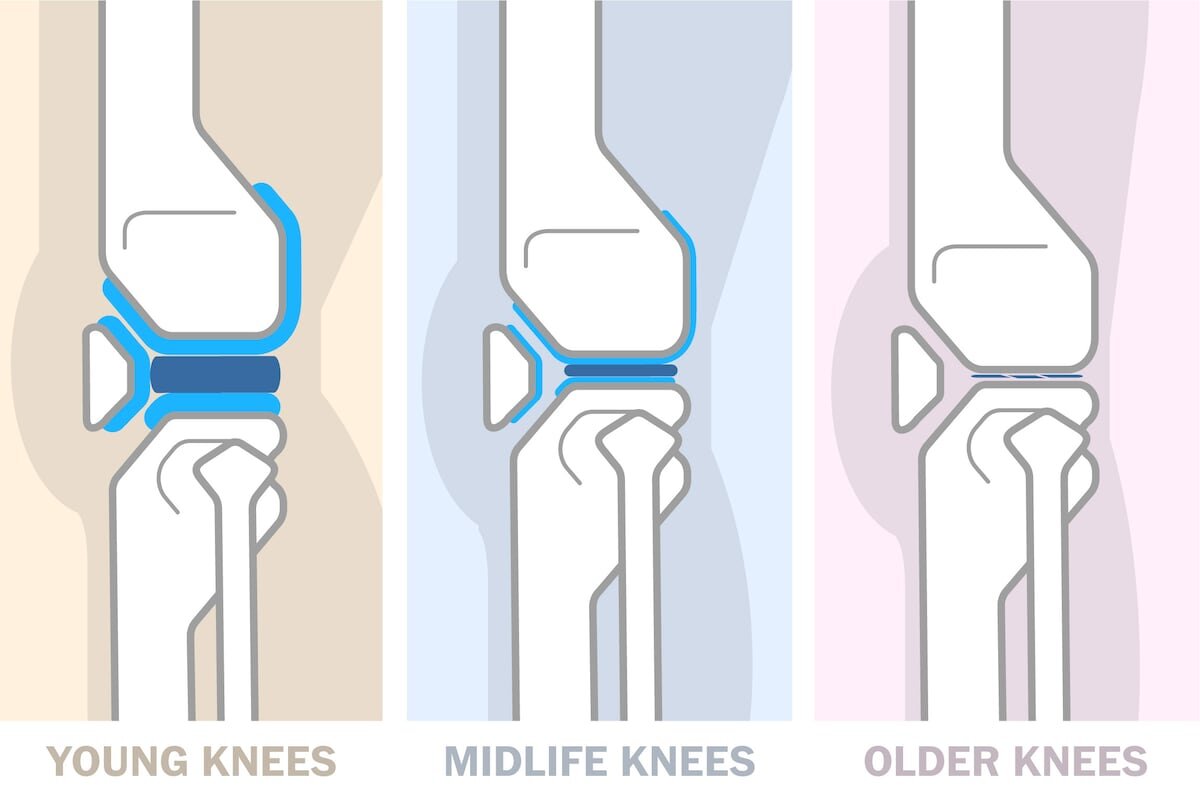 How to take care of your knees in your 20s, 30s, 40s and beyond - The Washington Post